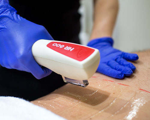 treatments-ellipse