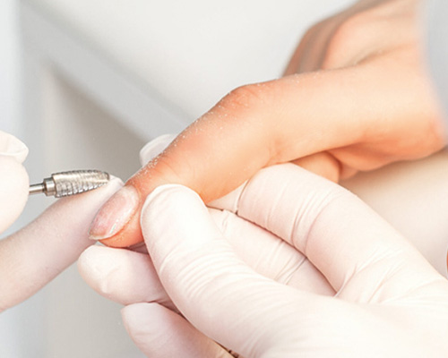 treatments-nails