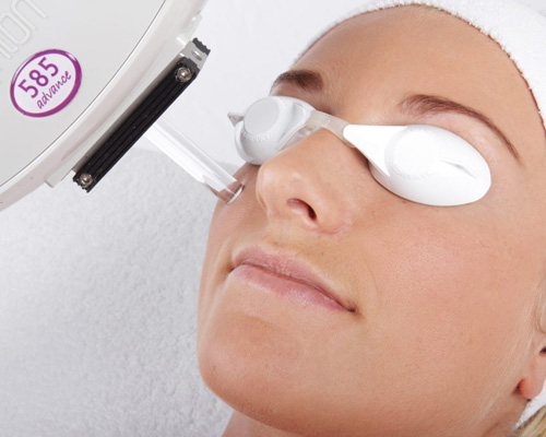 lynton ipl box